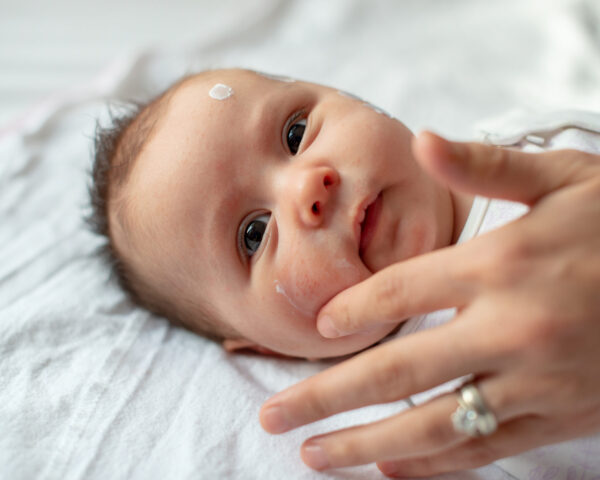 A baby lies on a white blanket with a hand gently touching their face. The baby has wide eyes and a small amount of Baby Barrier Balm Allergen & Skin Irritant Free is visible on their forehead. The baby is looking directly at the camera, safe in the knowledge that the product is both skin irritant-free and allergen-free.