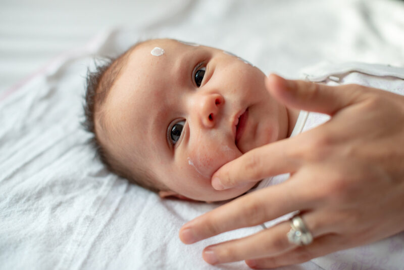 A baby lies on a white blanket with a hand gently touching their face. The baby has wide eyes and a small amount of Baby Barrier Balm Allergen & Skin Irritant Free is visible on their forehead. The baby is looking directly at the camera, safe in the knowledge that the product is both skin irritant-free and allergen-free.